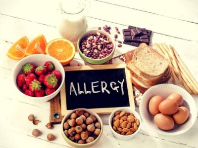 LISTA ALLERGENI E PRODOTTI SURGELATI