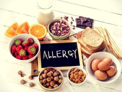 LISTA ALLERGENI E PRODOTTI SURGELATI